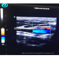 Máquina de ultra-som Doppler DW-C900 4D a cores com função de elastografia